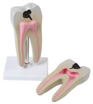 Модель коренного зуба