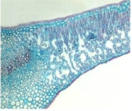 Клетки листа элодеи