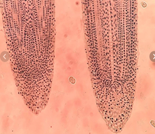 Деление клеток кончика корня лука