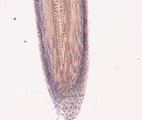 Кончик корня с корневым чехликом