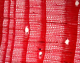 Продольный срез стебля древесного растения