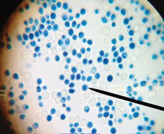 Дрожжи Дрожжи