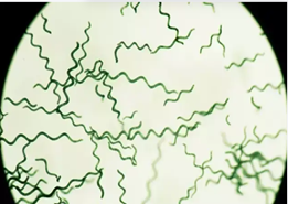 Спирогира Спирогира