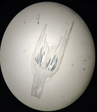 Антеридии мха (продольный срез) Антеридии мха (продольный срез)