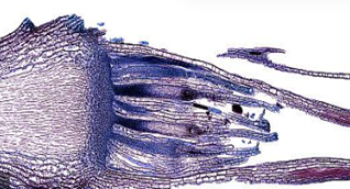 Архегонии мха (продольный срез) Архегонии мха (продольный срез)