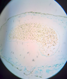 Спорогоний кукушкина льна Спорогоний кукушкина льна